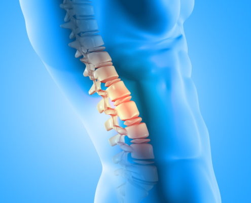 Osteoporosi negli Anziani: Prevenzione e Gestione